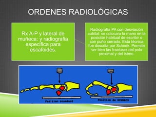 ORDENES RADIOLÓGICAS

                         Radiografía PA con desviación
 Rx A-P y lateral de    cubital: se colocara la mano en la
muñeca: y radiografia     posición habitual de escribir o
                         con puño cerrado. Esta técnica
  especifica para       fue descrita por Schnek. Permite
    escafoides.           ver bien las fracturas del polo
                               proximal y del istmo.
 