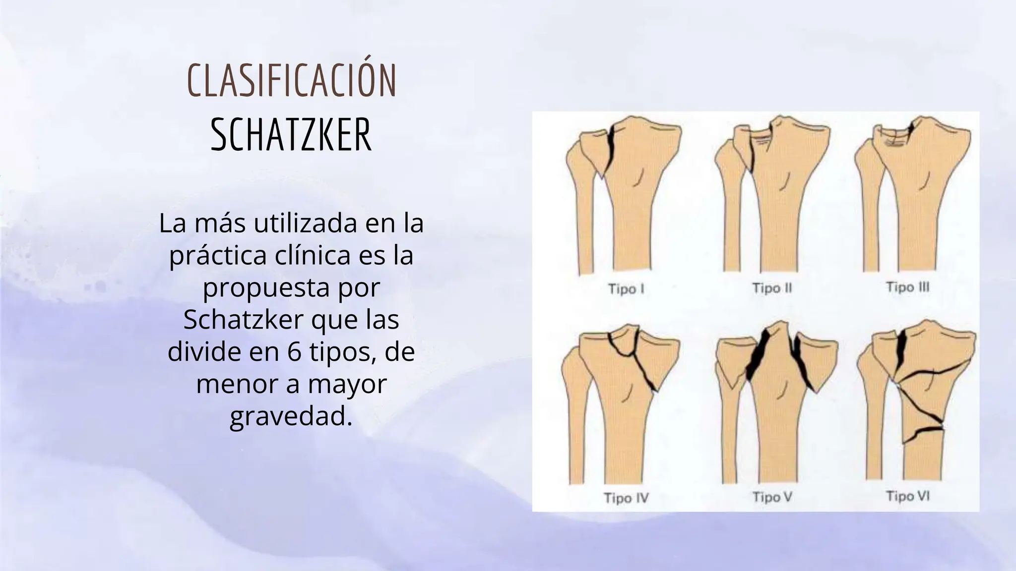 FRACTURAS DE LA MESETA TIBIAL c.pptx