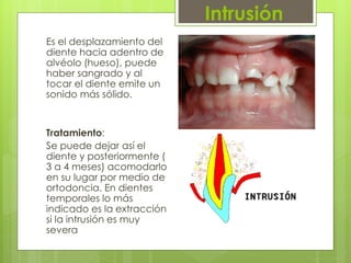 Intrusión
Es el desplazamiento del
diente hacia adentro de
alvéolo (hueso), puede
haber sangrado y al
tocar el diente emite un
sonido más sólido.
Tratamiento:
Se puede dejar así el
diente y posteriormente (
3 a 4 meses) acomodarlo
en su lugar por medio de
ortodoncia. En dientes
temporales lo más
indicado es la extracción
si la intrusión es muy
severa
 