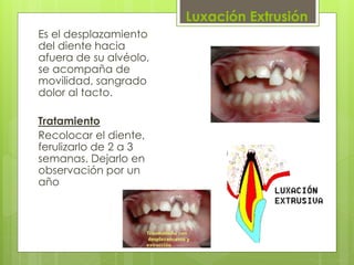 Luxación Extrusión
Es el desplazamiento
del diente hacia
afuera de su alvéolo,
se acompaña de
movilidad, sangrado
dolor al tacto.
Tratamiento
Recolocar el diente,
ferulizarlo de 2 a 3
semanas. Dejarlo en
observación por un
año
 