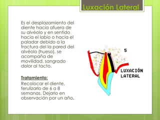 Luxación Lateral
Es el desplazamiento del
diente hacia afuera de
su alvéolo y en sentido
hacia el labio o hacia el
paladar debido a la
fractura del la pared del
alvéolo (hueso), se
acompaña de
movilidad, sangrado
dolor al tacto.
Tratamiento:
Recolocar el diente,
ferulizarlo de 6 a 8
semanas. Dejarlo en
observación por un año.
 