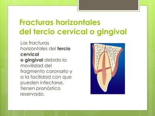 Fracturas horizontales
del tercio cervical o gingival
Las fracturas
horizontales del tercio
cervical
o gingival debido la
movilidad del
fragmento coronarlo y
a la facilidad con que
pueden infectarse,
tienen pronóstico
reservado.
 