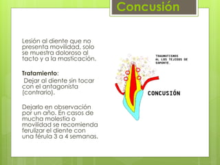 Concusión
Lesión al diente que no
presenta movilidad, solo
se muestra doloroso al
tacto y a la masticación.
Tratamiento:
Dejar al diente sin tocar
con el antagonista
(contrario).
Dejarlo en observación
por un año. En casos de
mucha molestia o
movilidad se recomienda
ferulizar el diente con
una férula 3 a 4 semanas.
 