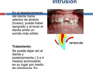 Intrusión
Es el desplazamiento
del diente hacia
adentro de alvéolo
(hueso), puede haber
sangrado y al tocar el
diente emite un
sonido más sólido.
Tratamiento:
Se puede dejar así el
diente y
posteriormente ( 3 a 4
meses) acomodarlo
en su lugar por medio
 