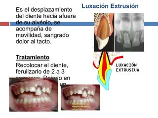 Luxación Extrusión
Es el desplazamiento
del diente hacia afuera
de su alvéolo, se
acompaña de
movilidad, sangrado
dolor al tacto.
Tratamiento
Recolocar el diente,
ferulizarlo de 2 a 3
semanas. Dejarlo en
observación por un
año
 