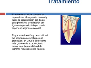 Tratamiento
El tratamiento inicial consiste en
reposicionar el segmento coronal y
luego la estabilización del diente
para permitir la cicatrización del
ligamento periodontal que brinda
soporte al segmento coronal.
El grado de luxación y de movilidad
del segmento coronal afecta el
pronóstico, en virtud e que cuanto
más grave es la luxación, tanto
menor será la probabilidad de
lograr la reducción de la fractura.
 