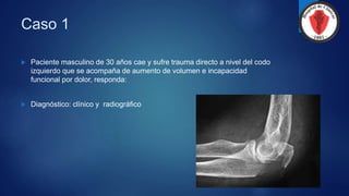 Caso 1
 Paciente masculino de 30 años cae y sufre trauma directo a nivel del codo
izquierdo que se acompaña de aumento de volumen e incapacidad
funcional por dolor, responda:
 Diagnóstico: clínico y radiográfico
 