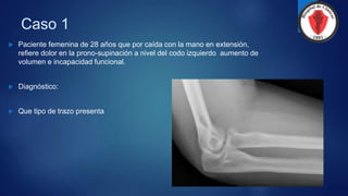 Caso 1
 Paciente femenina de 28 años que por caída con la mano en extensión,
refiere dolor en la prono-supinación a nivel del codo izquierdo aumento de
volumen e incapacidad funcional.
 Diagnóstico:
 Que tipo de trazo presenta
 