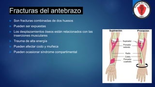 Fracturas del antebrazo
 Son fracturas combinadas de dos huesos
 Pueden ser expuestas
 Los desplazamientos óseos están relacionados con las
inserciones musculares
 Trauma de alta energía
 Pueden afectar codo y muñeca
 Pueden ocasionar síndrome compartimental
 