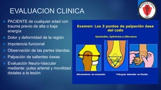EVALUACION CLINICA
 PACIENTE de cualquier edad con
trauma previo de alta o baja
energía
 Dolor y deformidad de la región
 Impotencia funcional
 Observación de las partes blandas
 Palpación de salientes óseas
 Evaluación Neuro-Vascular
mediante: pulso arterial y movilidad
distales a la lesión
 