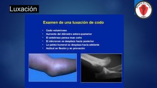Luxación
 