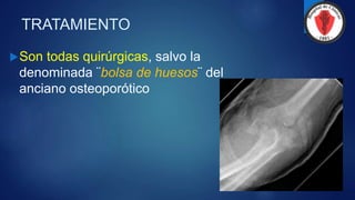 TRATAMIENTO
Son todas quirúrgicas, salvo la
denominada ¨bolsa de huesos¨ del
anciano osteoporótico
 