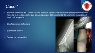 Caso 1
 Paciente femenina de 78 años la cual mientras deambula sufre caída que le produce trauma
indirecto del codo derecho que se acompaña de dolor, aumento de volumen e incapacidad
funcional, responda:
 Clasificación de la fractura
 Evaluación clínica:
 Evaluación radiográfica
 
