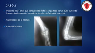 CASO 2
 Paciente de 21 años que conduciendo moto es impactado por un auto, sufriendo
trauma directo en codo, con dolor e impotencia funcional, responda:
 Clasificación de la fractura
 Evaluación clínica
 