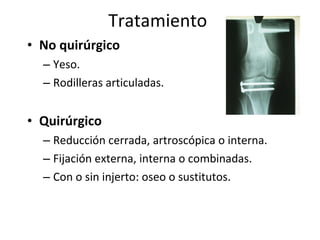 Fracturas de la rodilla | PPS