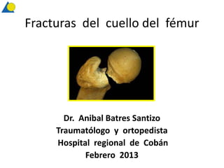 Fracturas del cuello del fémur




       Dr. Anibal Batres Santizo
     Traumatólogo y ortopedista
     Hospital regional de Cobán
            Febrero 2013
 