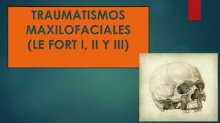 TRAUMATISMOS
MAXILOFACIALES
(LE FORT I, II Y III)

 