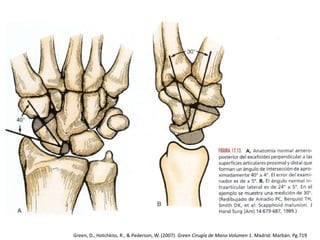 Green, D., Hotchkiss, R., & Pederson, W. (2007). Green Cirugía de Mano Volumen 1. Madrid: Marbán. Pg.719 
 