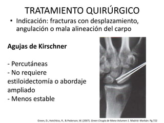 TRATAMIENTO QUIRÚRGICO 
• Indicación: fracturas con desplazamiento, 
angulación o mala alineación del carpo 
Agujas de Kirschner 
- Percutáneas 
- No requiere 
estiloidectomía o abordaje 
ampliado 
- Menos estable 
Green, D., Hotchkiss, R., & Pederson, W. (2007). Green Cirugía de Mano Volumen 1. Madrid: Marbán. Pg.722 
 