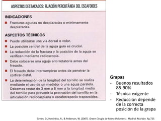 Grapas 
- Buenos resultados 
85-90% 
- Técnica exigente 
- Reducción depende 
de la correcta 
posición de la grapa 
Green, D., Hotchkiss, R., & Pederson, W. (2007). Green Cirugía de Mano Volumen 1. Madrid: Marbán. Pg.725 
 