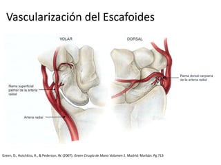 Vascularización del Escafoides 
Green, D., Hotchkiss, R., & Pederson, W. (2007). Green Cirugía de Mano Volumen 1. Madrid: Marbán. Pg.713 
 