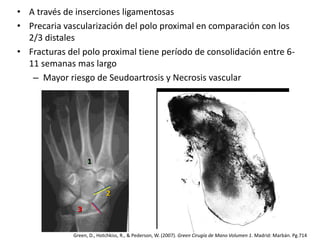 • A través de inserciones ligamentosas 
• Precaria vascularización del polo proximal en comparación con los 
2/3 distales 
• Fracturas del polo proximal tiene período de consolidación entre 6- 
11 semanas mas largo 
– Mayor riesgo de Seudoartrosis y Necrosis vascular 
1 
2 
3 
Green, D., Hotchkiss, R., & Pederson, W. (2007). Green Cirugía de Mano Volumen 1. Madrid: Marbán. Pg.714 
 