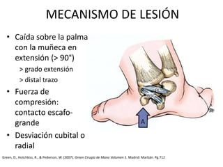MECANISMO DE LESIÓN 
• Caída sobre la palma 
con la muñeca en 
extensión (> 90°) 
> grado extensión 
> distal trazo 
• Fuerza de 
compresión: 
contacto escafo-grande 
• Desviación cubital o 
radial 
Green, D., Hotchkiss, R., & Pederson, W. (2007). Green Cirugía de Mano Volumen 1. Madrid: Marbán. Pg.712 
 