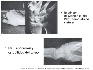 • Rx AP con 
desviación cubital: 
Perfil completo de 
cintura 
• Rx L: alineación y 
estabilidad del carpo 
Green, D., Hotchkiss, R., & Pederson, W. (2007). Green Cirugía de Mano Volumen 1. Madrid: Marbán. Pg.715 
 