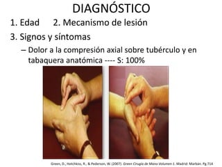 DIAGNÓSTICO 
1. Edad 2. Mecanismo de lesión 
3. Signos y síntomas 
– Dolor a la compresión axial sobre tubérculo y en 
tabaquera anatómica ---- S: 100% 
Green, D., Hotchkiss, R., & Pederson, W. (2007). Green Cirugía de Mano Volumen 1. Madrid: Marbán. Pg.714 
 