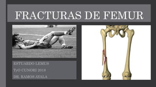 FRACTURAS DE FEMUR
ESTUARDO LEMUS
TyO CUNORI 2018
DR. RAMOS AYALA
 