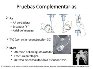 Fracturas del humero proximal y luxación glenohumeral.pptx