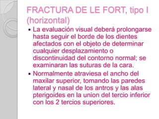 FRACTURA DE LE FORT, tipo I (horizontal)La evaluación visual deberá prolongarse hasta seguir el borde de los dientes afectados con el objeto de determinar cualquier desplazamiento o discontinuidad del contorno normal; se examinaran las suturas de la cara.Normalmente atraviesa el ancho del maxilar superior, tomando las paredes lateral y nasal de los antros y las alas pterigoides en la union del tercio inferior con los 2 tercios superiores.