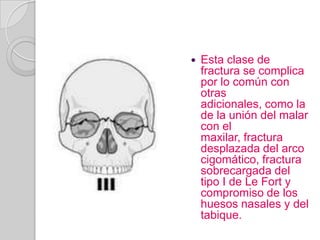 Esta clase de fractura se complica por lo común con otras adicionales, como la de la unión del malar con el maxilar, fractura desplazada del arco cigomático, fractura sobrecargada del tipo I de Le Fort y compromiso de los huesos nasales y del tabique.