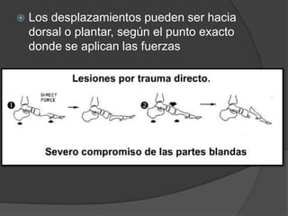  Los desplazamientos pueden ser hacia
dorsal o plantar, según el punto exacto
donde se aplican las fuerzas
 