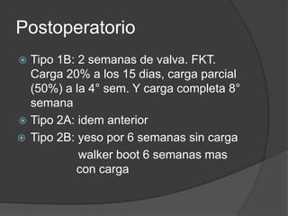 Postoperatorio
 Tipo 1B: 2 semanas de valva. FKT.
Carga 20% a los 15 dias, carga parcial
(50%) a la 4° sem. Y carga completa 8°
semana
 Tipo 2A: idem anterior
 Tipo 2B: yeso por 6 semanas sin carga
walker boot 6 semanas mas
con carga
 