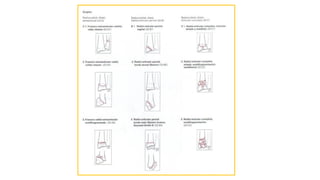 Comprehensive Overview of Upper Extremity Fractures: Diagnosis and ...