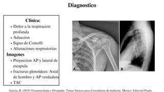 Fracturas del MS_20250512_232729_0000.pdf