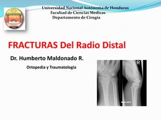 Universidad Nacional Autónoma de Honduras
                Facultad de Ciencias Medicas
                 Departamento de Cirugía




FRACTURAS Del Radio Distal
Dr. Humberto Maldonado R.
     Ortopedia y Traumatología
 