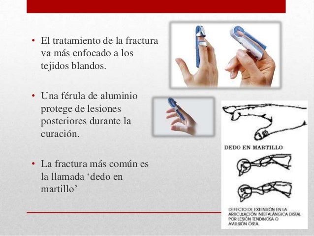 Las clínicas spb el tratamiento de la uña encarnada