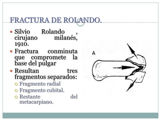 FRACTURA DE ROLANDO.
 Silvio Rolando ,
cirujano milanés,
1910.
 Fractura conminuta
que compromete la
base del pulgar
 Resultan tres
fragmentos separados:
 Fragmento radial
 Fragmento cubital.
 Restante del
metacarpiano.
 