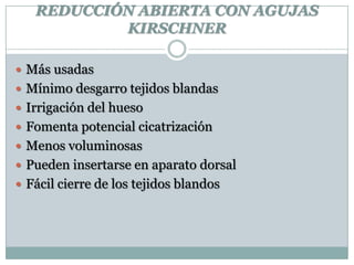 REDUCCIÓN ABIERTA CON AGUJAS
KIRSCHNER
 Más usadas
 Mínimo desgarro tejidos blandas
 Irrigación del hueso
 Fomenta potencial cicatrización
 Menos voluminosas
 Pueden insertarse en aparato dorsal
 Fácil cierre de los tejidos blandos
 