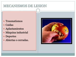 MECANISMOS DE LESION
 Traumatismos
 Caídas
 Aplastamientos
 Máquina industrial
 Deportes
 Abiertas o cerradas.
 