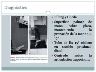 Diagnóstico
 Billing y Gueda
 Superficie palmar de
mano sobre placa,
manteniendo la
pronación de la mano 10-
15°
 Tubo de Rx 15° oblicuo
en sentido proximal-
distal
 Centrado sobre la
articulación trapeciomtc
 