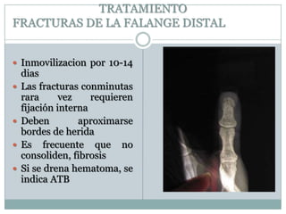 TRATAMIENTO
FRACTURAS DE LA FALANGE DISTAL
 Inmovilizacion por 10-14
dias
 Las fracturas conminutas
rara vez requieren
fijación interna
 Deben aproximarse
bordes de herida
 Es frecuente que no
consoliden, fibrosis
 Si se drena hematoma, se
indica ATB
 