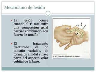 Mecanismo de lesión
 La lesión ocurre
cuando el 1° mtc sufre
una compresión axial
parcial combinado con
fuerza de torsión
 El fragmento
fracturado es de
tamaño variable, de
forma piramidal y hace
parte del aspecto volar
cubital de la base.
 