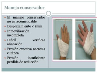 Manejo conservador
 El manejo conservador
no es recomendable
 Desplazamiento < 1mm
 Inmovilización
incompleta
 Dificil verificar
alineación
 Presión excesiva necrosis
cutánea
 Presión insuficiente
pérdida de reducción
 