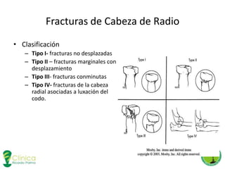 fracturas-de-miembros-superiores-pptx
