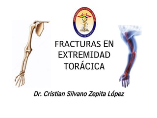 FRACTURAS EN
EXTREMIDAD
TORÁCICA
Dr. Cristian Silvano Zepita López
 