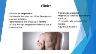 Clínica
Fracturas no desplazadas:
•Impotencia funcional parcial por la respuesta
muscular antiálgica
•Dolor selectivo a la presión del hombro
•Actitud antiálgica sujetándose el brazo con el
otro miembro
Fracturas desplazadas:
•Impotencia funcional del hombro
absoluta
•Crepitación a la abducción del
hombro
•Equimosis marcada
 