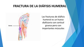 FRACTURA DE LA DIÁFISIS HUMERAL
Las fracturas de diáfisis
humeral es un hueso
diafisiario con cortical
gruesa pero con
importantes músculos
 